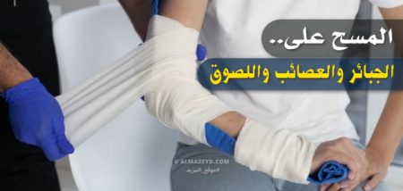 المسح على الجبائر والعصائب واللصوق.. مختصر