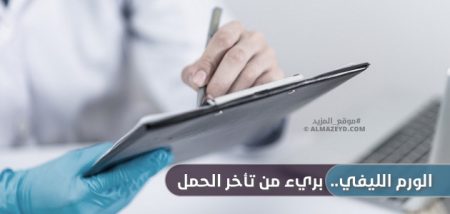 الورم الليفي.. بريء من تأخر الحمل