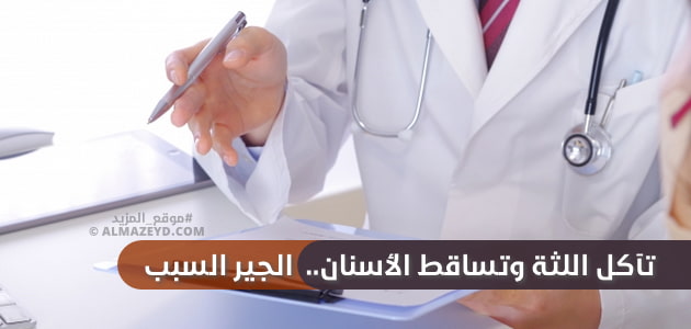 تآكل اللثة وتساقط الأسنان.. الجير السبب