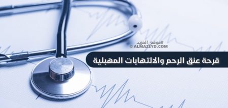 قرحة عنق الرحم والالتهابات المهبلية.. هناك فرق