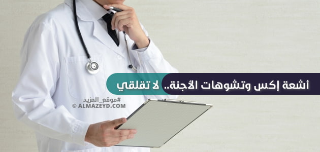 أشعة إكس وتشوهات الأجنة.. لا تقلقي