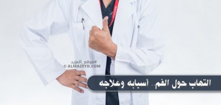 تعاني من التهاب حول الفم؟ هنا تتعرَّف على أسبابه وعلاجه