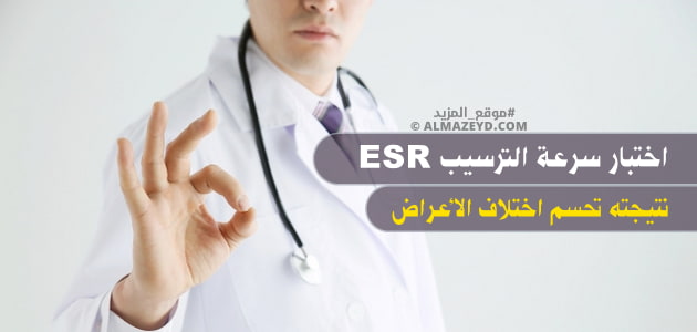 اختبار سرعة الترسيب ESR .. نتيجته تحسم اختلاف الأعراض