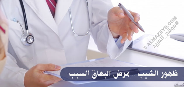ظهور الشيب .. مرض البهاق السبب
