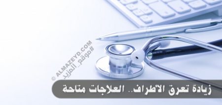 زيادة تعرق الأطراف.. العلاجات متاحة