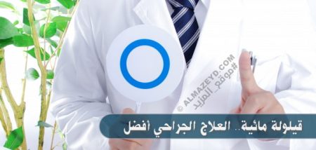 قيلولة مائية.. العلاج الجراحي أفضل