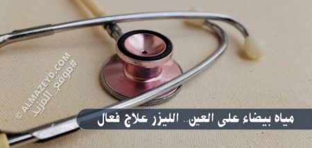 مياه بيضاء على العين.. الليزر علاج فعال