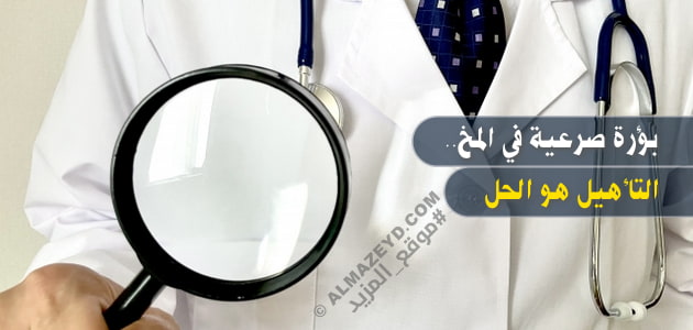 بؤرة صرعية في المخ.. التأهيل هو الحل