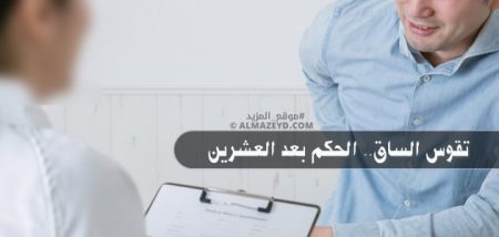 تقوس الساق.. الحكم بعد العشرين