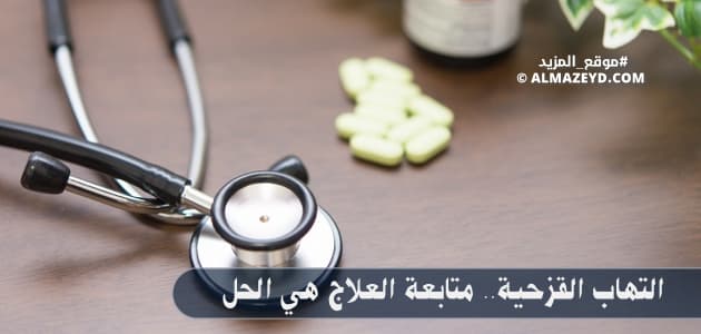 التهاب القزحية.. متابعة العلاج هي الحل