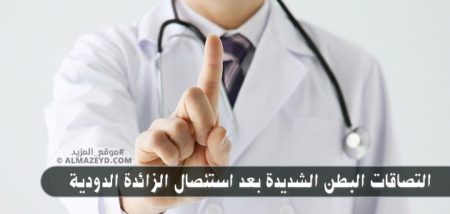 ما سبب التصاقات البطن الشديدة بعد استئصال الزائدة الدودية؟