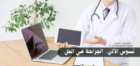 تسوس الأذن.. الجراحة هي الحل