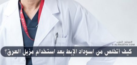 كيف أتخلص من اسوداد الإبط بعد استخدام مزيل العرق؟