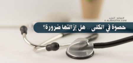 حصوة في الكلى .. هل إزالتها ضرورة؟