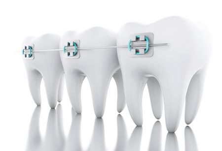 طب الأسنان , teeth , صورة