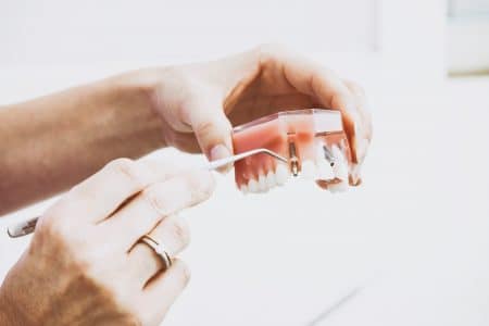صورة , طب الأسنان , علاج الأسنان
