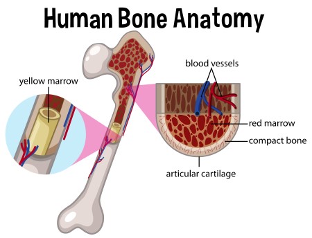 نخاع العظم ، زراعة النخاع ، اعتلالات العظام ، العمود الفقري