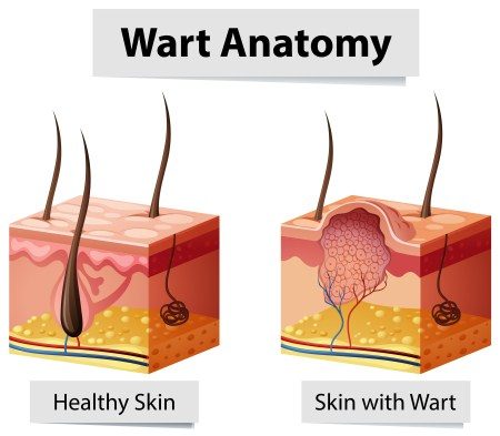 شد الوجه ، الكولاجين ، التجميل ، عمليات التجميل