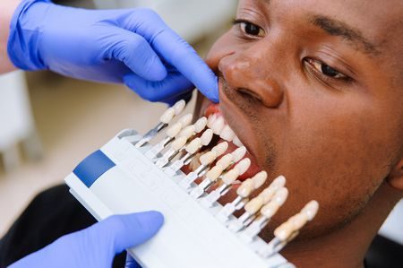 خيارات تجميل الأسنان , Cosmetic Dentistry