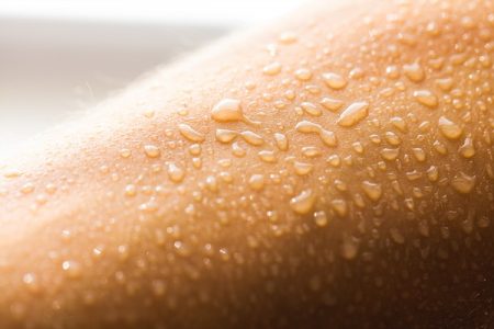 التعرق الزائد ، Excessive sweating ، صورة