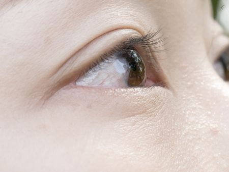 مرض , رمد العين , Eye ophthalmology , صورة