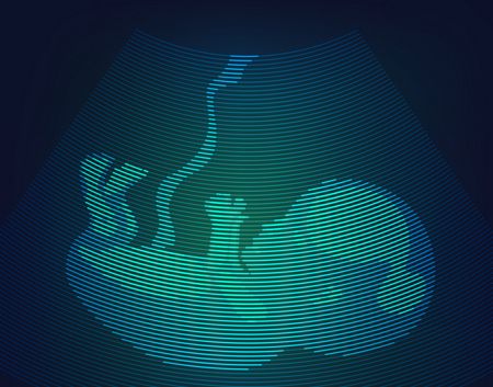 الحمل الكاذب , False pregnancy , الحمل الزائف , صورة