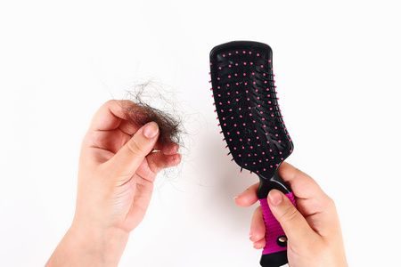 تساقط الشعر ، Hair loss ، صورة