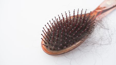 علاج تساقط الشعر عند النساء
