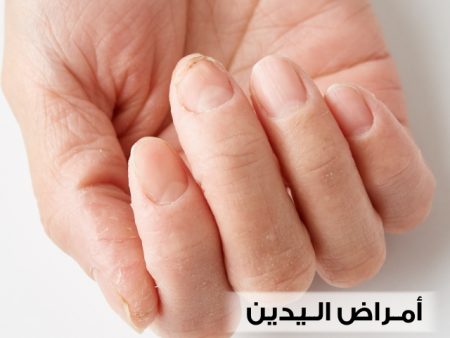 أمراض اليدين ، يد ، صورة ، أصابع
