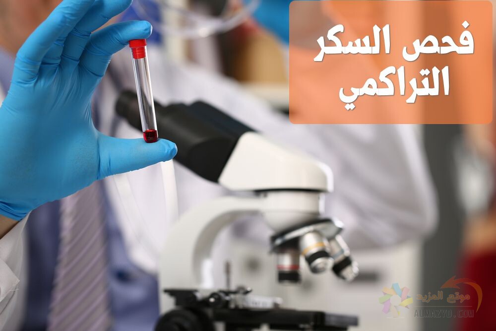 فحص السكر التراكمي , Diabetes, HbA1c