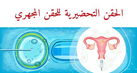 الحقن التحضيرية للحقن المجهري