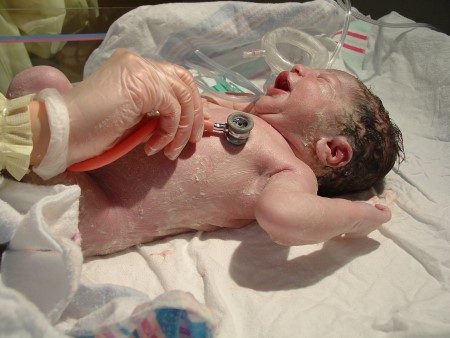 الولادة المبكرة ، الخديج ، الخداج ، اعتلالات المولود 