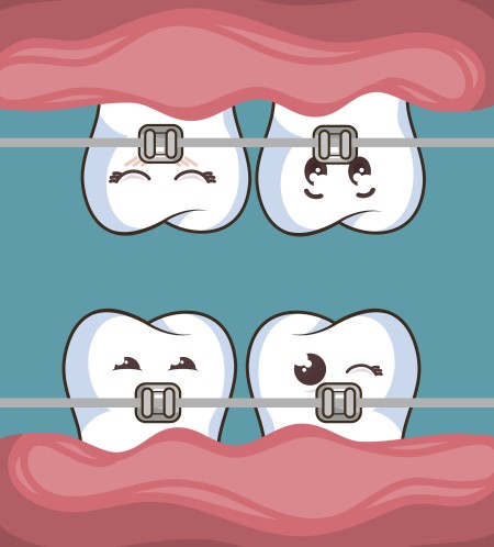 تقويم الأسنان ، مشاكل اللثة ، شكل الفكين ، التهابات اللثة