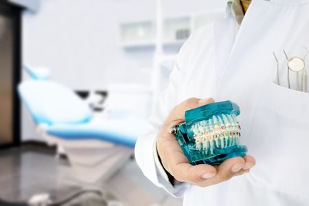 تقويم الأسنان , Orthodontics , صورة