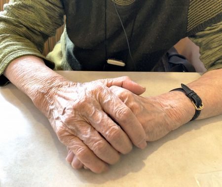 مرض باركنسون , Parkinson's disease , صورة