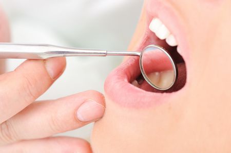 حشوات الأسنان , Silver, tooth fillings , حشوات فضية , صورة