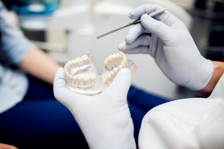 تقنية 3n ، الأسنان ، تجميل الأسنان ، طب الأسنان ، المشاهير ، تسوس الأسنان