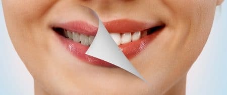 تبييض الأسنان ، Teeth whitening ، صورة ، أسنان