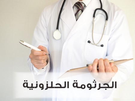 الجرثومة الحلزونية وعلاجها