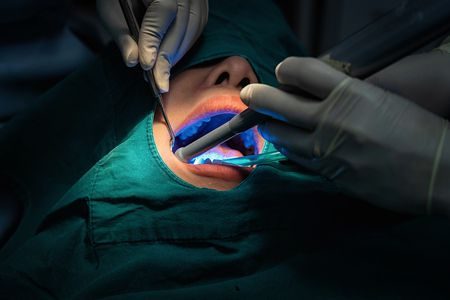 صورة , أسنان , طب الأسنان , التقنيات الحديثة