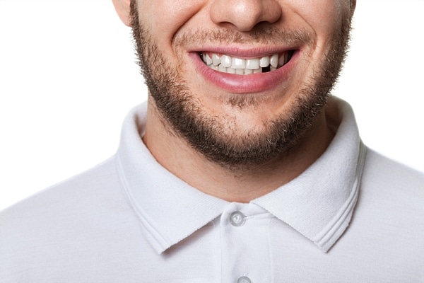 ما هي أبرز التقنيات الحديثة في تجميل الأسنان