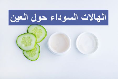 الهالات السوداء