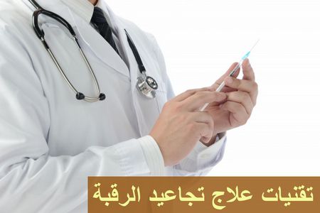 تجاعيد الرقبة