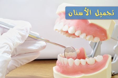 تجميل الأسنان