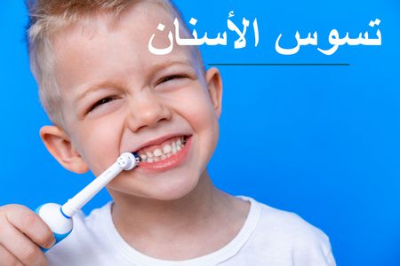 تسوس الأسنان لدى الأطفال والمتابعة مع الطبيب