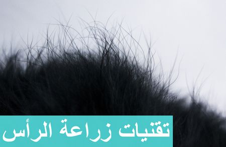 زراعة الرأس