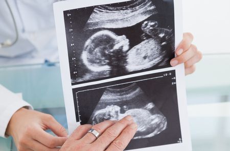 تقنية التشخيص الوراثي للأجنة وتحديد جنس المولود