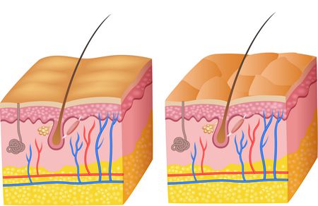 جهاز Fractional Laser العلاج الأمثل للتصبغات الجلدية