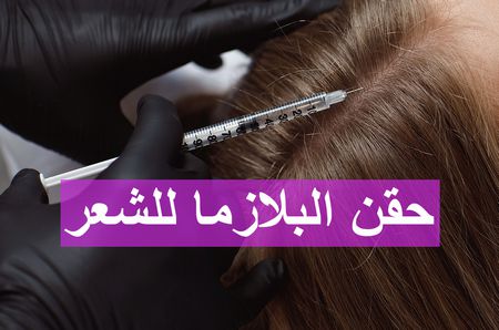 حقن البلازما