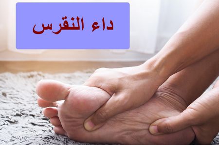 أسماء أدوية النقرس: 23 علاج متوفر في الصيدليات بمعلوماته التفصيلية